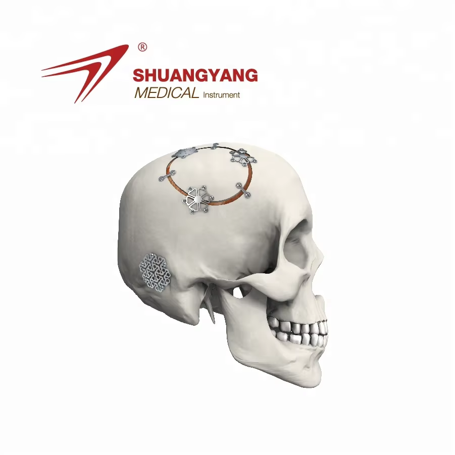 medical flat titanium mesh manufacturers 