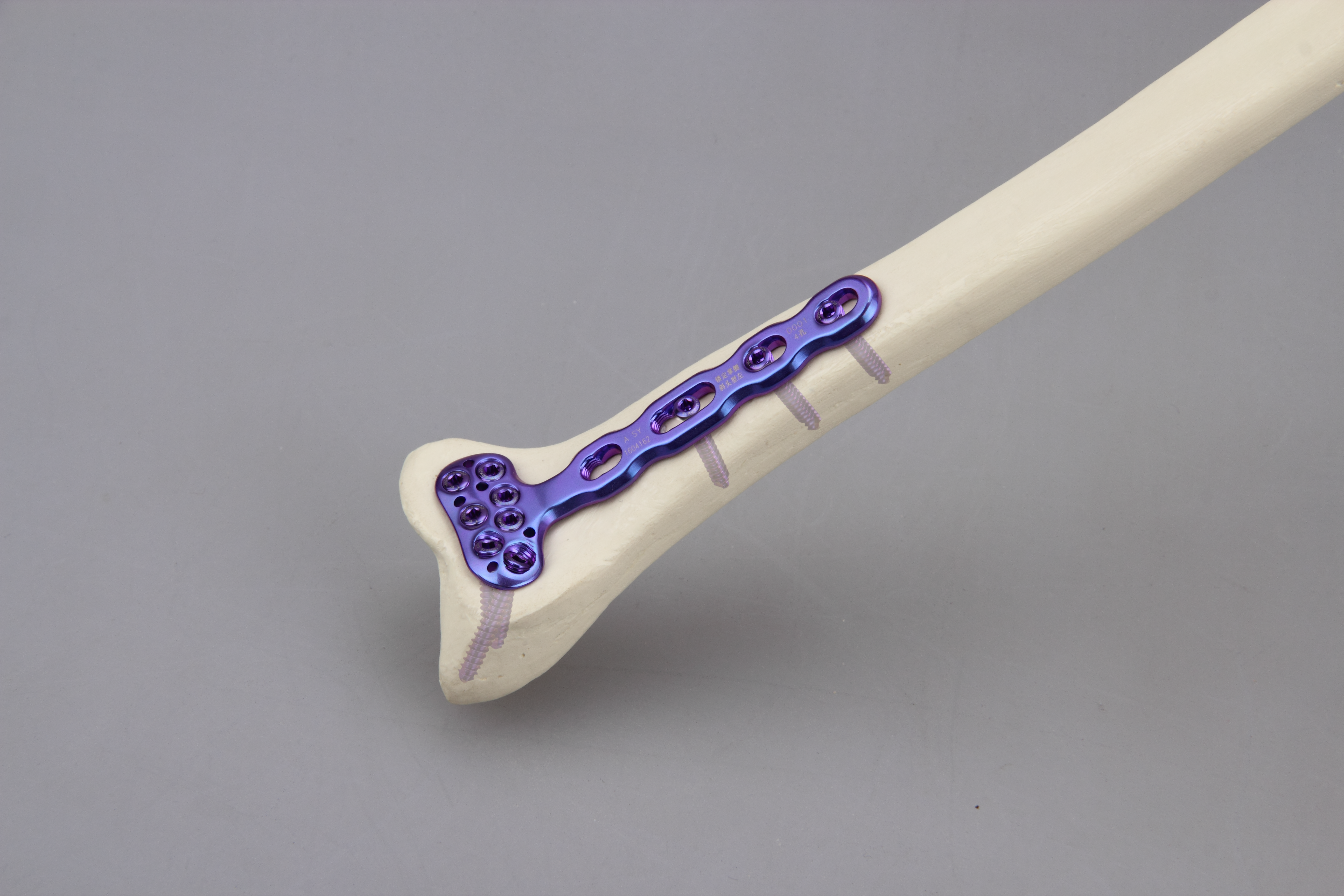 custom locking plates