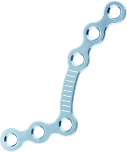 سۆڭەك سۆڭەك تەخسىسى